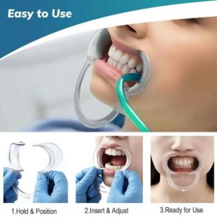 12 PCs Double Cheek Retractor by | Small Double Head C-Shape Cheek Retractors Opener | Autoclavable Mouth Opener Retractors for Teeth Whitening
